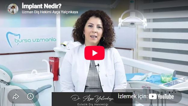 İmplant Nedir?