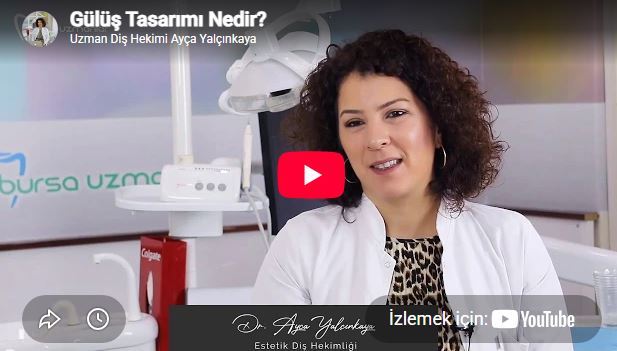 Gülüş Tasarımı Nedir?